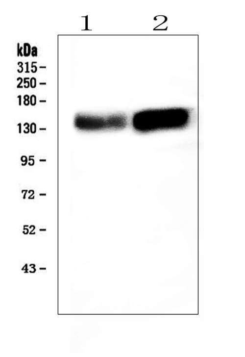 Western blot analysis of ADAMTS13 using anti-ADAMTS13 antibody (PB10028). Electrophoresis was performed on a 5-20% SDS-PAGE gel at 70V (Stacking gel) / 90V (Resolving gel) for 2-3 hours. The sample well of each lane was loaded with 50ug of sample under reducing conditions. Lane 1: mouse liver tissue lysates, Lane 2: rat brain tissue lysates, After Electrophoresis, proteins were transferred to a Nitrocellulose membrane at 150mA for 50-90 minutes. Blocked the membrane with 5% Non-fat Milk/ TBS for 1.5 hour at RT. The membrane was incubated with rabbit anti-ADAMTS13 antigen affinity purified polyclonal antibody (Catalog # PB10028) at 0.5 μg/mL overnight at 4°C, then washed with TBS-0.1%Tween 3 times with 5 minutes each and probed with a goat anti-rabbit IgG-HRP secondary antibody at a dilution of 1:10000 for 1.5 hour at RT. The signal is developed using an Enhanced Chemiluminescent detection (ECL) kit (Catalog # EK1002) with Tanon 5200 system. A specific band was detected for ADAMTS13 at approximately 154KD. The expected band size for ADAMTS13 is at 154KD.