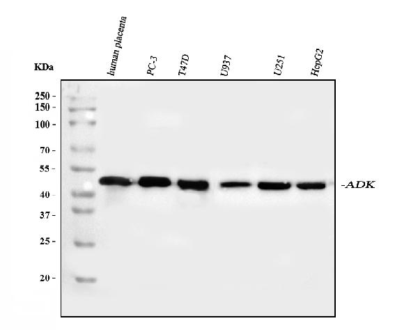 Western blot analysis of ADK using anti-ADK antibody (PB10031).