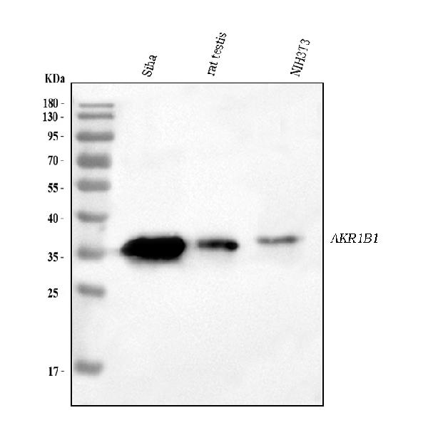 Western blot analysis of AKR1B1 using anti-AKR1B1 antibody (PB10035).