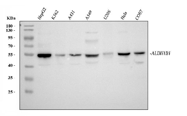 Western blot analysis of ALDH1B1 using anti-ALDH1B1 antibody (PB10037).