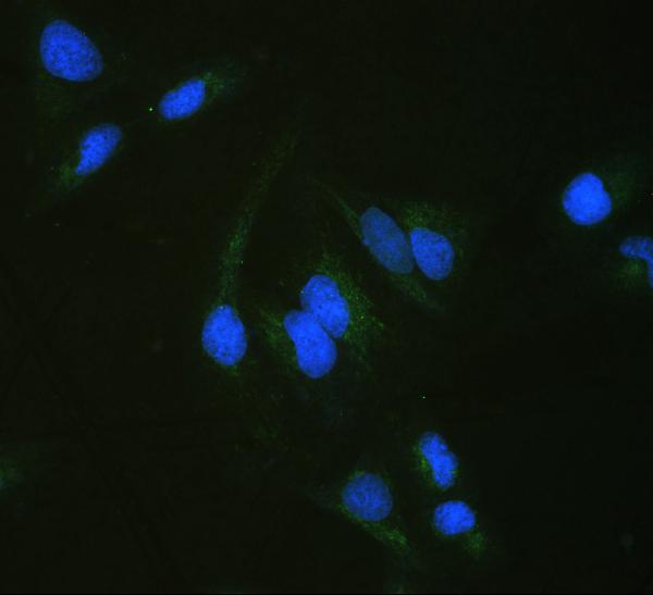 IF analysis of ALDH7A1 using anti-ALDH7A1 antibody (PB10038). ALDH7A1 was detected in immunocytochemical section of U20S cell. Enzyme antigen retrieval was performed using IHC enzyme antigen retrieval reagent (AR0022) for 15 mins. The cells were blocked with 10% goat serum. And then incubated with 2μg/mL rabbit anti-ALDH7A1 Antibody (PB10038) overnight at 4°C. DyLight®488 Conjugated Goat Anti-Rabbit IgG (BA1127) was used as secondary antibody at 1:100 dilution and incubated for 30 minutes at 37°C. The section was counterstained with DAPI. Visualize using a fluorescence microscope and filter sets appropriate for the label used.