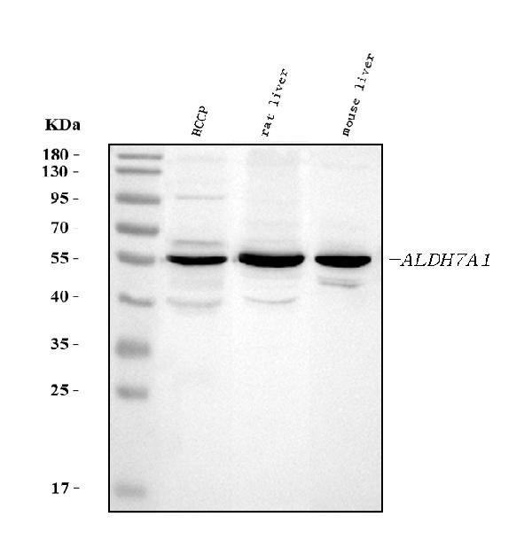 Western blot analysis of ALDH7A1 using anti-ALDH7A1 antibody (PB10038).