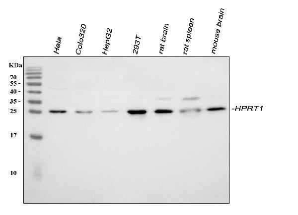 Western blot analysis of HPRT/HPRT1 using anti-HPRT/HPRT1 antibody (PB10071).