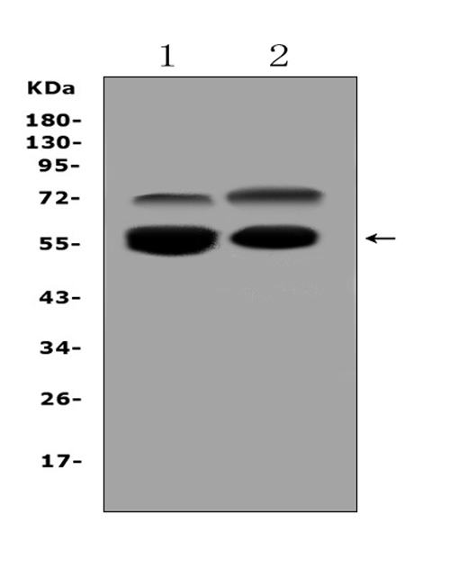 Western blot analysis of VNN1 using anti-VNN1 antibody (PB10106).