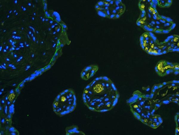 IF analysis of ITGB4 using anti-ITGB4 antibody (PB9007) ITGB4 was detected in paraffin-embedded section of human placenta tissues. Heat mediated antigen retrieval was performed in citrate buffer (pH6, epitope retrieval solution ) for 20 mins. The tissue section was blocked with 10% goat serum. The tissue section was then incubated with 1μg/mL rabbit anti-ITGB4 Antibody (PB9007) overnight at 4°C. DyLight®488 Conjugated Goat Anti-Rabbit IgG (BA1127) was used as secondary antibody at 1:100 dilution and incubated for 30 minutes at 37°C. The section was counterstained with DAPI. Visualize using a fluorescence microscope and filter sets appropriate for the label used.