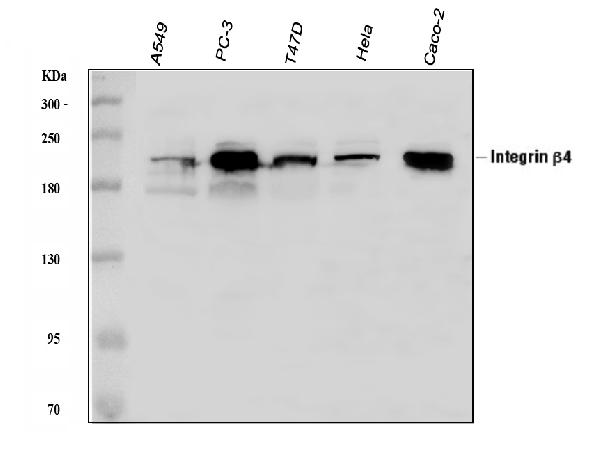 Western blot analysis of ITGB4 using anti-ITGB4 antibody (PB9007).