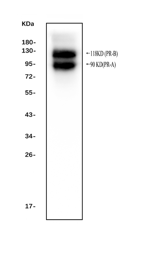 Western blot analysis of Progesterone Receptor using anti-Progesterone Receptor antibody (PB9009). Electrophoresis was performed on a 5-20% SDS-PAGE gel at 70V (Stacking gel) / 90V (Resolving gel) for 2-3 hours. The sample well of each lane was loaded with 50ug of sample under reducing conditions. Lane 1: human T-47D whole cell lysates, After Electrophoresis, proteins were transferred to a Nitrocellulose membrane at 150mA for 50-90 minutes. Blocked the membrane with 5% Non-fat Milk/ TBS for 1.5 hour at RT. The membrane was incubated with rabbit anti-Progesterone Receptor antigen affinity purified polyclonal antibody (Catalog # PB9009) at 0.1 μg/mL overnight at 4°C, then washed with TBS-0.1%Tween 3 times with 5 minutes each and probed with a goat anti-rabbit IgG-HRP secondary antibody at a dilution of 1:10000 for 1.5 hour at RT. The signal is developed using an Enhanced Chemiluminescent detection (ECL) kit (Catalog # EK1002) with Tanon 5200 system. A specific band was detected for Progesterone Receptor at approximately 90 KD (PR-A), 118KD (PR-B). The expected band size for Progesterone Receptor is at 99KD.