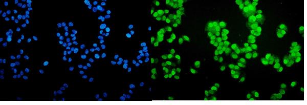 IF analysis of Progesterone Receptor using anti-Progesterone Receptor antibody (PB9009).