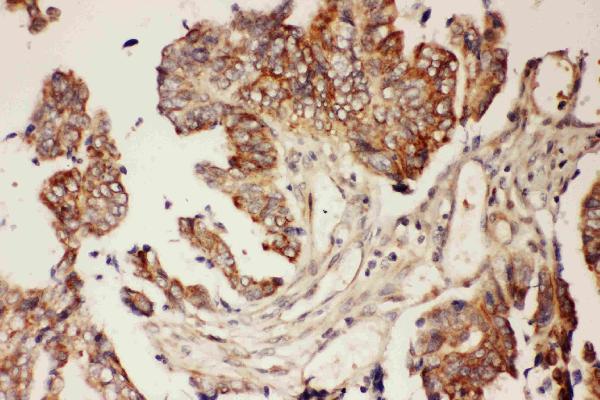 IHC analysis of CNTF using anti-CNTF antibody (PB9012).