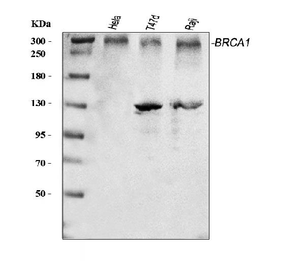 Western blot analysis of BRCA1 using anti-BRCA1 antibody (PB9015).