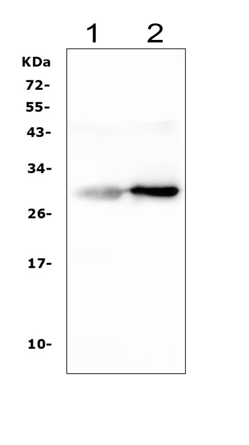 Western blot analysis of Serum Amyloid P using anti-Serum Amyloid P antibody (PB9021). Electrophoresis was performed on a 5-20% SDS-PAGE gel at 70V (Stacking gel) / 90V (Resolving gel) for 2-3 hours. The sample well of each lane was loaded with 50ug of sample under reducing conditions. Lane 1: rat liver tissue lysates, Lane 2: mouse liver tissue lysates. After Electrophoresis, proteins were transferred to a Nitrocellulose membrane at 150mA for 50-90 minutes. Blocked the membrane with 5% Non-fat Milk/ TBS for 1.5 hour at RT. The membrane was incubated with rabbit anti-Serum Amyloid P antigen affinity purified polyclonal antibody (Catalog # PB9021) at 0.5 μg/mL overnight at 4°C, then washed with TBS-0.1%Tween 3 times with 5 minutes each and probed with a goat anti-rabbit IgG-HRP secondary antibody at a dilution of 1:10000 for 1.5 hour at RT. The signal is developed using an Enhanced Chemiluminescent detection (ECL) kit (Catalog # EK1002) with Tanon 5200 system. A specific band was detected for Serum Amyloid P at approximately 29KD. The expected band size for Serum Amyloid P is at 25KD.