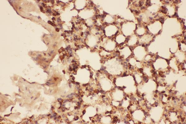 IHC analysis of Cofilin using anti-Cofilin antibody (PB9033).