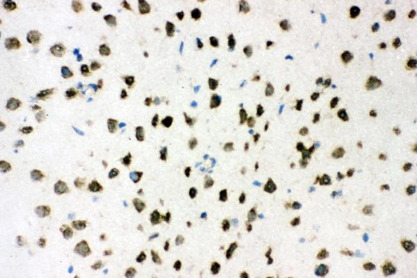 IHC analysis of AKT2 using anti-AKT2 antibody (PB9043). AKT2 was detected in frozen section of rat brain tissues. The tissue section was blocked with 10% goat serum. The tissue section was then incubated with 1μg/ml rabbit anti-AKT2 Antibody (PB9043) overnight at 4°C. Biotinylated goat anti-rabbit IgG was used as secondary antibody and incubated for 30 minutes at 37°C. The tissue section was developed using Strepavidin-Biotin-Complex (SABC)(Catalog # SA1022) with DAB as the chromogen.