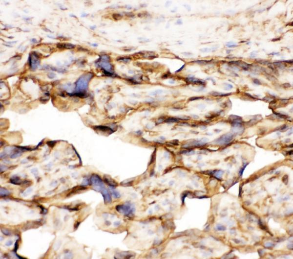 IHC analysis of Annexin V using anti-Annexin V antibody (PB9044). Annexin V was detected in frozen section of human placenta tissues. The tissue section was blocked with 10% goat serum. The tissue section was then incubated with 1μg/ml rabbit anti-Annexin V Antibody (PB9044) overnight at 4°C. Biotinylated goat anti-rabbit IgG was used as secondary antibody and incubated for 30 minutes at 37°C. The tissue section was developed using Strepavidin-Biotin-Complex (SABC)(Catalog # SA1022) with DAB as the chromogen.