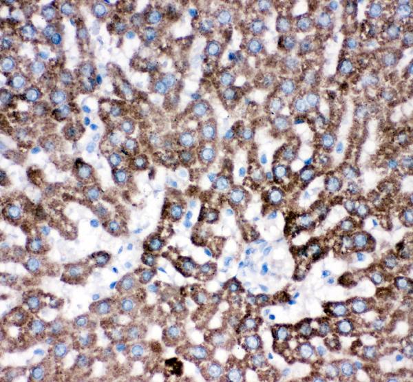 IHC analysis of Cathepsin D using anti-Cathepsin D antibody (PB9048). Cathepsin D was detected in paraffin-embedded section of rat liver tissues. Heat mediated antigen retrieval was performed in citrate buffer (pH6, epitope retrieval solution) for 20 mins. The tissue section was blocked with 10% goat serum. The tissue section was then incubated with 1μg/ml rabbit anti-Cathepsin D Antibody (PB9048) overnight at 4°C. Biotinylated goat anti-rabbit IgG was used as secondary antibody and incubated for 30 minutes at 37°C. The tissue section was developed using Strepavidin-Biotin-Complex (SABC)(Catalog # SA1022) with DAB as the chromogen.