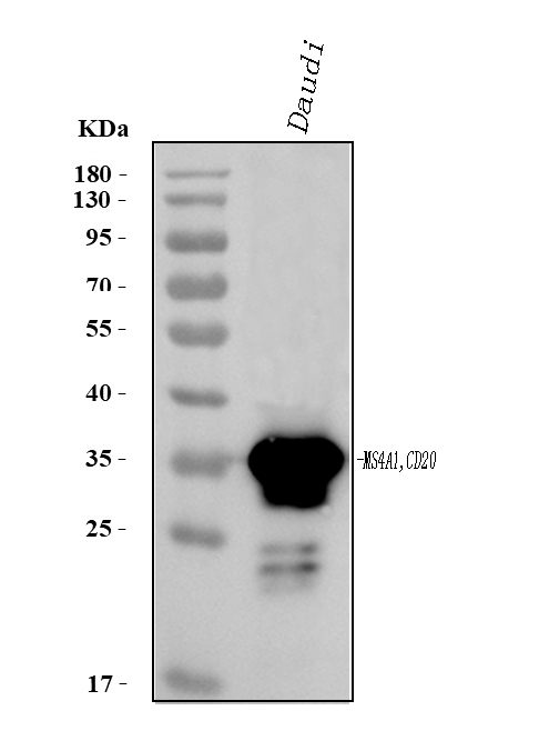 Western blot analysis of CD20 using anti-CD20 antibody (PB9050).