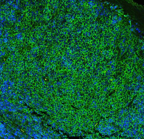 IF analysis of CD23 using anti-CD23 antibody (PB9051) CD23 was detected in paraffin-embedded section of rat lymphaden tissues. Heat mediated antigen retrieval was performed in citrate buffer (pH6, epitope retrieval solution ) for 20 mins. The tissue section was blocked with 10% goat serum. The tissue section was then incubated with 1μg/mL rabbit anti-CD23 Antibody (PB9051) overnight at 4°C. DyLight®488 Conjugated Goat Anti-Rabbit IgG (BA1127) was used as secondary antibody at 1:100 dilution and incubated for 30 minutes at 37°C. The section was counterstained with DAPI. Visualize using a fluorescence microscope and filter sets appropriate for the label used.