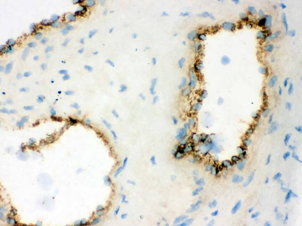 IHC analysis of VWF using anti-VWF antibody (PB9062). VWF was detected in frozen section of human placenta tissue. The tissue section was blocked with 10% goat serum. The tissue section was then incubated with 1μg/ml rabbit anti-VWF Antibody (PB9062) overnight at 4°C. Biotinylated goat anti-rabbit IgG was used as secondary antibody and incubated for 30 minutes at 37°C. The tissue section was developed using Strepavidin-Biotin-Complex (SABC)(Catalog # SA1022) with DAB as the chromogen.