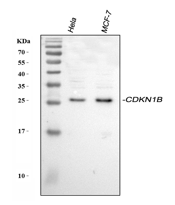 Western blot analysis of p27 KIP 1/CDKN1B using anti-p27 KIP 1/CDKN1B antibody (PB9070).