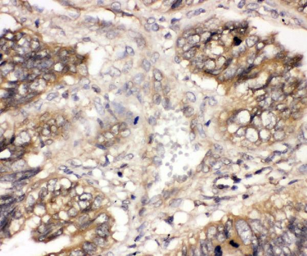 IHC analysis of CBL using anti-CBL antibody (PB9077).