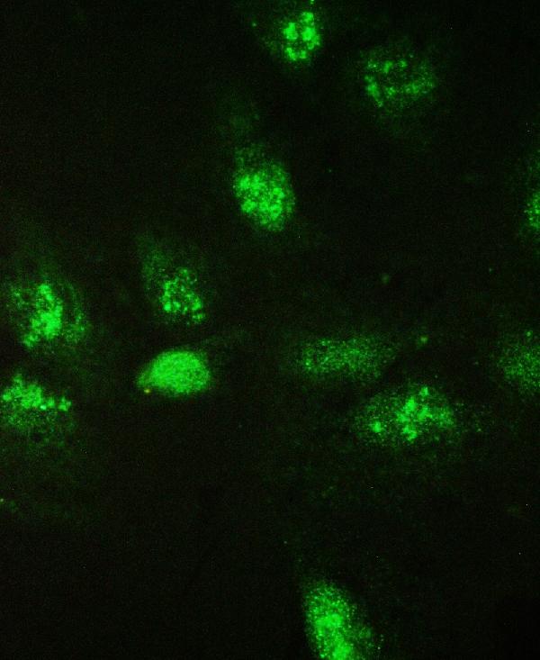 IF analysis of Galectin-3 using anti-Galectin-3 antibody (PB9081). Galectin-3 was detected in immunocytochemical section of U20S cell. Enzyme antigen retrieval was performed using IHC enzyme antigen retrieval reagent (AR0022) for 15 mins. The cells were blocked with 10% goat serum. And then incubated with 2μg/mL rabbit anti-Galectin-3 Antibody (PB9081) overnight at 4°C. DyLight®488 Conjugated Goat Anti-Rabbit IgG (BA1127) was used as secondary antibody at 1:100 dilution and incubated for 30 minutes at 37°C. Visualize using a fluorescence microscope and filter sets appropriate for the label used.