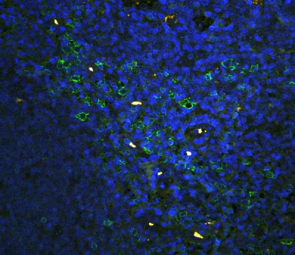 IF analysis of CD43 using anti-CD43 antibody (PB9095) CD43 was detected in paraffin-embedded section of human tonsil tissues. Heat mediated antigen retrieval was performed in citrate buffer (pH6, epitope retrieval solution ) for 20 mins. The tissue section was blocked with 10% goat serum. The tissue section was then incubated with 1μg/mL rabbit anti-CD43 Antibody (PB9095) overnight at 4°C. DyLight®488 Conjugated Goat Anti-Rabbit IgG (BA1127) was used as secondary antibody at 1:100 dilution and incubated for 30 minutes at 37°C. The section was counterstained with DAPI. Visualize using a fluorescence microscope and filter sets appropriate for the label used.