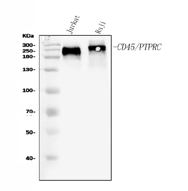 Western blot analysis of CD45 using anti-CD45 antibody (PB9096).