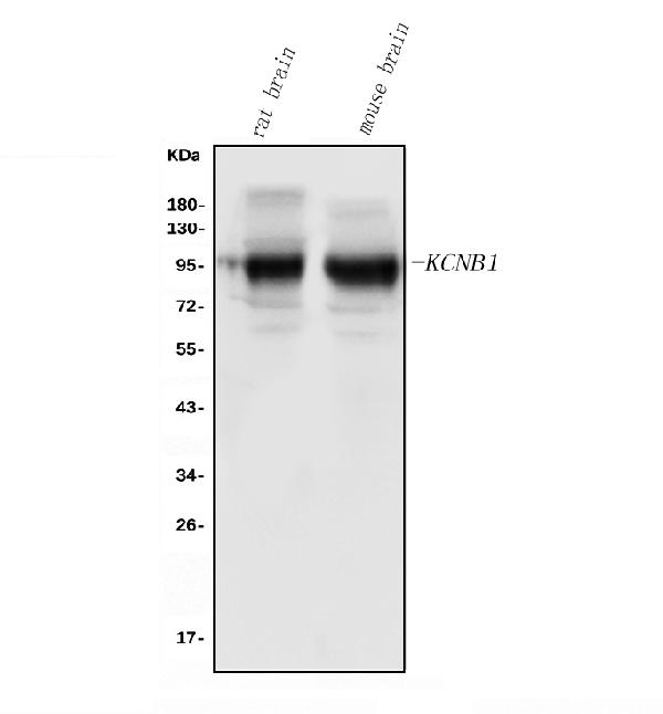 Western blot analysis of Kv2.1 using anti-Kv2.1 antibody (PB9111).