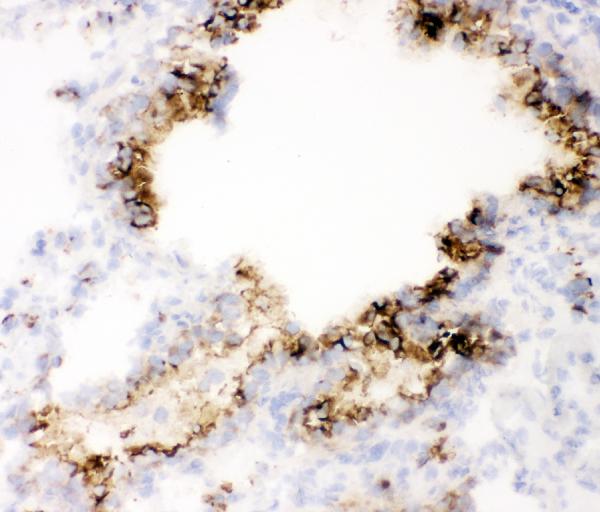 IHC analysis of MUC1 using anti-MUC1 antibody (PB9112). MUC1 was detected in frozen section of mouse lung tissues. The tissue section was blocked with 10% goat serum. The tissue section was then incubated with 1μg/ml rabbit anti-MUC1 Antibody (PB9112) overnight at 4°C. Biotinylated goat anti-rabbit IgG was used as secondary antibody and incubated for 30 minutes at 37°C. The tissue section was developed using Strepavidin-Biotin-Complex (SABC)(Catalog # SA1022) with DAB as the chromogen.