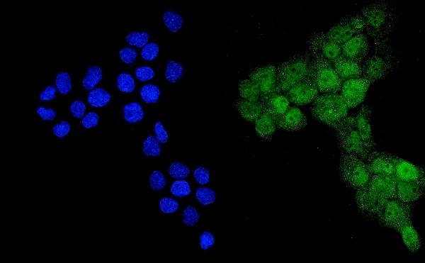 IF analysis of Ubiquitin using anti-Ubiquitin antibody (PB9122).