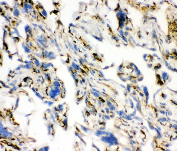 IHC analysis of ACE using anti-ACE antibody (PB9124). ACE was detected in frozen section of human placenta tissues. The tissue section was blocked with 10% goat serum. The tissue section was then incubated with 1μg/ml rabbit anti-ACE Antibody (PB9124) overnight at 4°C. Biotinylated goat anti-rabbit IgG was used as secondary antibody and incubated for 30 minutes at 37°C. The tissue section was developed using Strepavidin-Biotin-Complex (SABC)(Catalog # SA1022) with DAB as the chromogen.