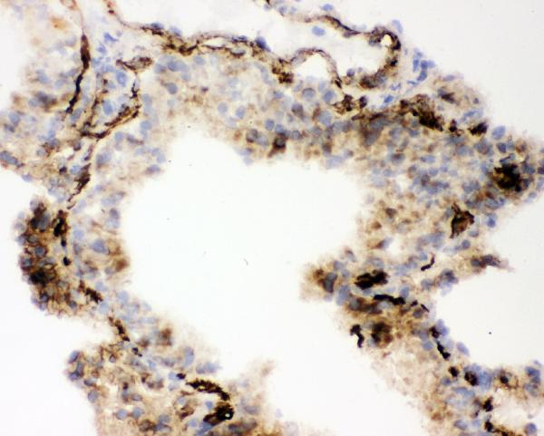 IHC analysis of ACE using anti-ACE antibody (PB9124). ACE was detected in frozen section of mouse lung tissues. The tissue section was blocked with 10% goat serum. The tissue section was then incubated with 1μg/ml rabbit anti-ACE Antibody (PB9124) overnight at 4°C. Biotinylated goat anti-rabbit IgG was used as secondary antibody and incubated for 30 minutes at 37°C. The tissue section was developed using Strepavidin-Biotin-Complex (SABC)(Catalog # SA1022) with DAB as the chromogen.