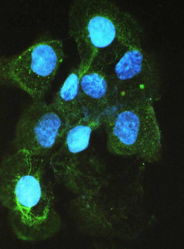 IF analysis of ACE using anti-ACE antibody (PB9124). ACE was detected in immunocytochemical section of A431 cell. Enzyme antigen retrieval was performed using IHC enzyme antigen retrieval reagent (AR0022) for 15 mins. The cells were blocked with 10% goat serum. And then incubated with 2μg/mL rabbit anti-ACE Antibody (PB9124) overnight at 4°C. DyLight®488 Conjugated Goat Anti-Rabbit IgG (BA1127) was used as secondary antibody at 1:100 dilution and incubated for 30 minutes at 37°C. The section was counterstained with DAPI. Visualize using a fluorescence microscope and filter sets appropriate for the label used.