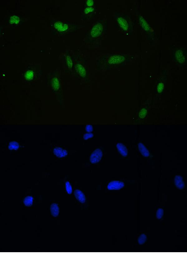 IF analysis of APEX1 using anti-APEX1 antibody (PB9128). APEX1 was detected in immunocytochemical section of U20S cell. Enzyme antigen retrieval was performed using IHC enzyme antigen retrieval reagent (AR0022) for 15 mins. The cells were blocked with 10% goat serum. And then incubated with 2μg/mL rabbit anti-APEX1 Antibody (PB9128) overnight at 4°C. DyLight®488 Conjugated Goat Anti-Rabbit IgG (BA1127) was used as secondary antibody at 1:100 dilution and incubated for 30 minutes at 37°C. The section was counterstained with DAPI. Visualize using a fluorescence microscope and filter sets appropriate for the label used.