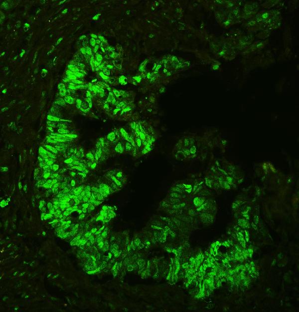 IF analysis of APEX1 using anti-APEX1 antibody (PB9128).