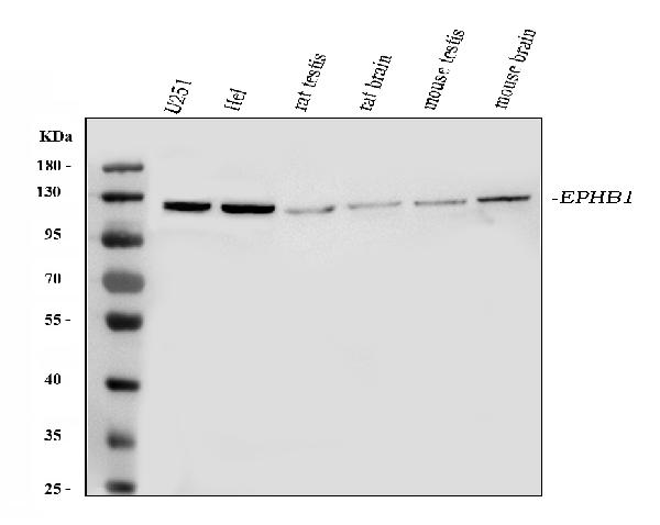 Western blot analysis of Eph receptor B1 using anti-Eph receptor B1 antibody (PB9584).