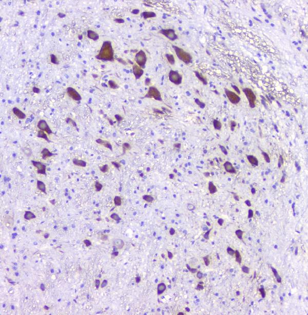 IHC analysis of 5HT2A Receptor using anti-5HT2A Receptor antibody (PB9599). 5HT2A Receptor was detected in paraffin-embedded section of rat brain tissues. Heat mediated antigen retrieval was performed in citrate buffer (pH6, epitope retrieval solution) for 20 mins. The tissue section was blocked with 10% goat serum. The tissue section was then incubated with 1μg/ml rabbit anti-5HT2A Receptor Antibody (PB9599) overnight at 4°C. Biotinylated goat anti-rabbit IgG was used as secondary antibody and incubated for 30 minutes at 37°C. The tissue section was developed using Strepavidin-Biotin-Complex (SABC)(Catalog # SA1022) with DAB as the chromogen.