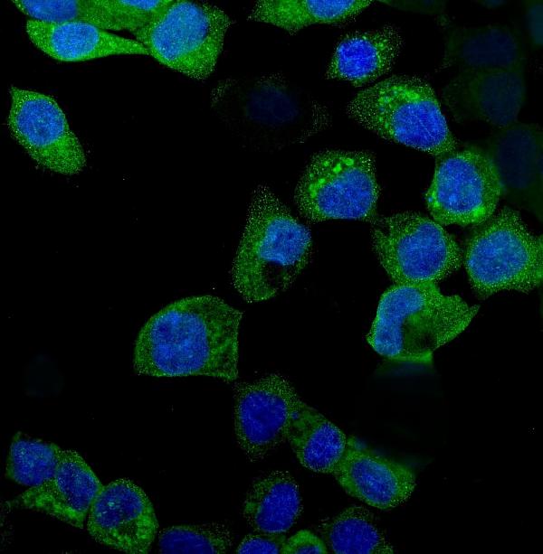 IF analysis of IDO1 using anti-IDO1 antibody (PB9603).