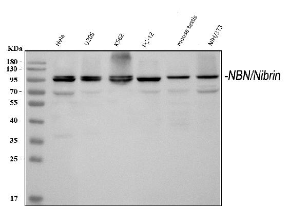 Western blot analysis of p95 NBS1 using anti-p95 NBS1 antibody (PB9615).