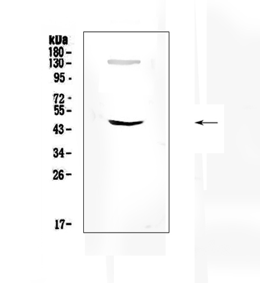 Western blot analysis of SOX4 using anti-SOX4 antibody (PB9618). Electrophoresis was performed on a 5-20% SDS-PAGE gel at 70V (Stacking gel) / 90V (Resolving gel) for 2-3 hours. The sample well of each lane was loaded with 50ug of sample under reducing conditions. Lane 1: mouse brain tissue lysates. After Electrophoresis, proteins were transferred to a Nitrocellulose membrane at 150mA for 50-90 minutes. Blocked the membrane with 5% Non-fat Milk/ TBS for 1.5 hour at RT. The membrane was incubated with rabbit anti-SOX4 antigen affinity purified polyclonal antibody (Catalog # PB9618) at 0.5 μg/mL overnight at 4°C, then washed with TBS-0.1%Tween 3 times with 5 minutes each and probed with a goat anti-rabbit IgG-HRP secondary antibody at a dilution of 1:10000 for 1.5 hour at RT. The signal is developed using an Enhanced Chemiluminescent detection (ECL) kit (Catalog # EK1002) with Tanon 5200 system. A specific band was detected for SOX4 at approximately 47KD. The expected band size for SOX4 is at 47KD.