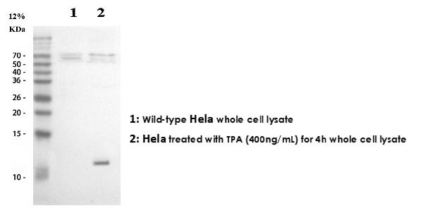 Western blot analysis of IL-8 using anti-IL-8 antibody (PB9621).