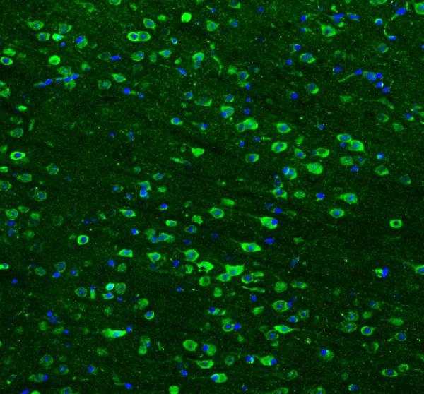 IF analysis of HSP90AB1 using anti-HSP90AB1 antibody (PB9636) HSP90AB1 was detected in paraffin-embedded section of mouse brain tissues. Heat mediated antigen retrieval was performed in citrate buffer (pH6, epitope retrieval solution ) for 20 mins. The tissue section was blocked with 10% goat serum. The tissue section was then incubated with 2μg/mL rabbit anti-HSP90AB1 Antibody (PB9636) overnight at 4°C. DyLight®488 Conjugated Goat Anti-Rabbit IgG (BA1127) was used as secondary antibody at 1:100 dilution and incubated for 30 minutes at 37°C. The section was counterstained with DAPI. Visualize using a fluorescence microscope and filter sets appropriate for the label used.