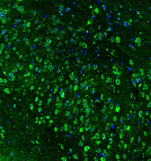 IF analysis of HSP90AB1 using anti-HSP90AB1 antibody (PB9636) HSP90AB1 was detected in paraffin-embedded section of mouse brain tissues. Heat mediated antigen retrieval was performed in citrate buffer (pH6, epitope retrieval solution ) for 20 mins. The tissue section was blocked with 10% goat serum. The tissue section was then incubated with 2μg/mL rabbit anti-HSP90AB1 Antibody (PB9636) overnight at 4°C. DyLight®488 Conjugated Goat Anti-Rabbit IgG (BA1127) was used as secondary antibody at 1:100 dilution and incubated for 30 minutes at 37°C. The section was counterstained with DAPI. Visualize using a fluorescence microscope and filter sets appropriate for the label used.