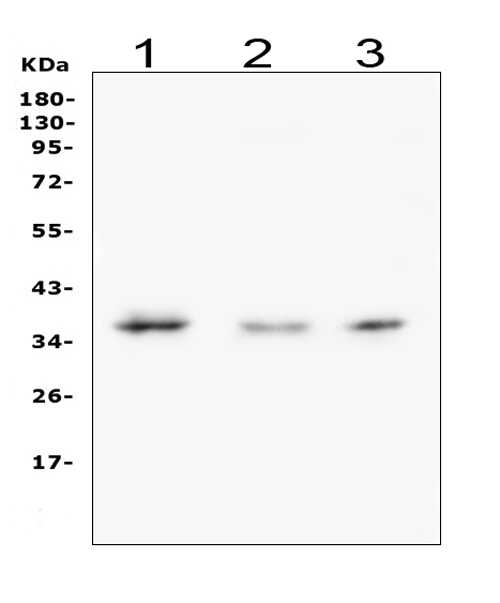 Western blot analysis of Galectin 8 using anti-Galectin 8 antibody (PB9659). Electrophoresis was performed on a 5-20% SDS-PAGE gel at 70V (Stacking gel) / 90V (Resolving gel) for 2-3 hours. The sample well of each lane was loaded with 50ug of sample under reducing conditions. Lane 1: human COLO-320 whole cell lysates Lane 2: rat testicular tissue lysates Lane 3: mouse Neuro-2A whole cell lysates After Electrophoresis, proteins were transferred to a Nitrocellulose membrane at 150mA for 50-90 minutes. Blocked the membrane with 5% Non-fat Milk/ TBS for 1.5 hour at RT. The membrane was incubated with rabbit anti-Galectin 8 antigen affinity purified polyclonal antibody (Catalog # PB9659) at 0.5 μg/mL overnight at 4°C, then washed with TBS-0.1%Tween 3 times with 5 minutes each and probed with a goat anti-rabbit IgG-HRP secondary antibody at a dilution of 1:10000 for 1.5 hour at RT. The signal is developed using an Enhanced Chemiluminescent detection (ECL) kit (Catalog # EK1002) with Tanon 5200 system. A specific band was detected for Galectin 8 at approximately 36KD. The expected band size for Galectin 8 is at 36KD.