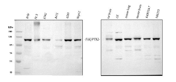 Western blot analysis of FAK/PTK2 using anti-FAK/PTK2 antibody (PB9674).