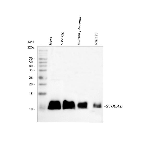 Western blot analysis of S100A6 using anti-S100A6 antibody (PB9676).