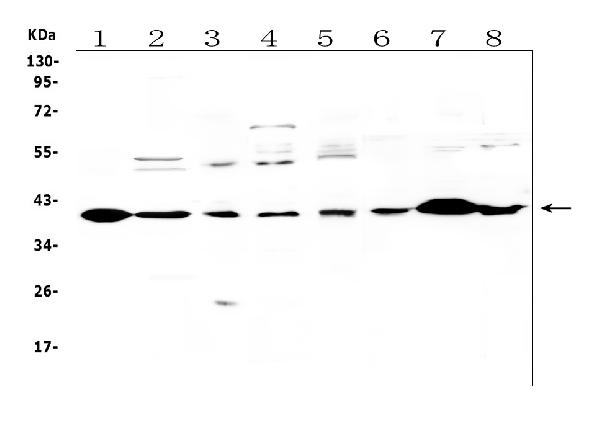 Western blot analysis of IGFBP-3 using anti-IGFBP-3 antibody (PB9710). Electrophoresis was performed on a 5-20% SDS-PAGE gel at 70V (Stacking gel) / 90V (Resolving gel) for 2-3 hours. The sample well of each lane was loaded with 50ug of sample under reducing conditions. Lane 1: rat heart tissue lysates, Lane 2: rat brain tissue lysates, Lane 3: rat liver tissue lysates, Lane 4: rat PC-12 whole cell lysates. Lane 5: human U-87MG whole cell lysates. Lane 6: mouse kidney tissue lysates, Lane 7: mouse heart tissue lysates, Lane 8: mouse brain tissue lysates, After Electrophoresis, proteins were transferred to a Nitrocellulose membrane at 150mA for 50-90 minutes. Blocked the membrane with 5% Non-fat Milk/ TBS for 1.5 hour at RT. The membrane was incubated with rabbit anti-IGFBP-3 antigen affinity purified polyclonal antibody (Catalog # PB9710) at 0.5 μg/mL overnight at 4°C, then washed with TBS-0.1%Tween 3 times with 5 minutes each and probed with a goat anti-rabbit IgG-HRP secondary antibody at a dilution of 1:10000 for 1.5 hour at RT. The signal is developed using an Enhanced Chemiluminescent detection (ECL) kit (Catalog # EK1002) with Tanon 5200 system. A specific band was detected for IGFBP-3 at approximately 40KD. The expected band size for IGFBP-3 is at 32KD.