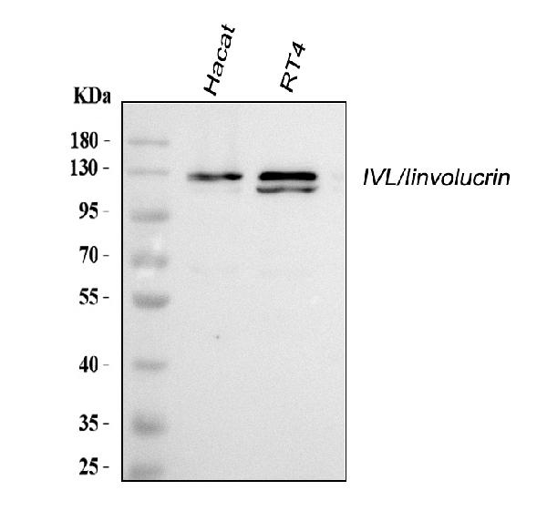 Western blot analysis of Involucrin/IVL using anti-Involucrin/IVL antibody (PB9712).