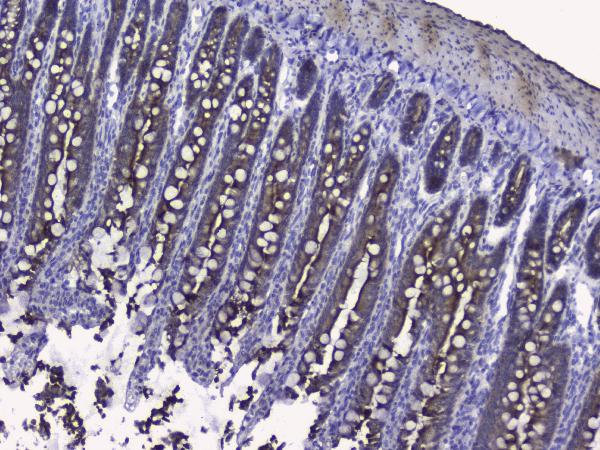 IHC analysis of KRT19 using anti-KRT19 antibody (PB9715). KRT19 was detected in paraffin-embedded section of rat small intestine tissues. Heat mediated antigen retrieval was performed in citrate buffer (pH6, epitope retrieval solution) for 20 mins. The tissue section was blocked with 10% goat serum. The tissue section was then incubated with 2μg/ml rabbit anti-KRT19 Antibody (PB9715) overnight at 4°C. Biotinylated goat anti-rabbit IgG was used as secondary antibody and incubated for 30 minutes at 37°C. The tissue section was developed using Strepavidin-Biotin-Complex (SABC)(Catalog # SA1022) with DAB as the chromogen.