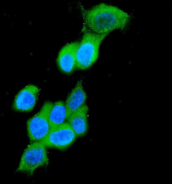 IF analysis of Cytokeratin 19 using anti-Cytokeratin 19 antibody (PB9715).